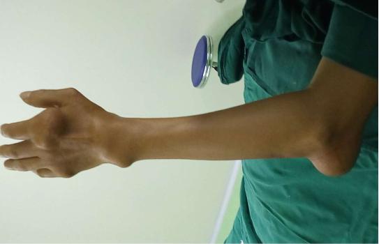 Ժ˫ֹؽڶദСһʹʯ)