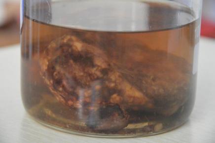 ֣ʹʪҽԺʪչʹʯ걾