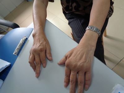 �������ƺ󣬻����ֲ�ʹ��ʯ�Ѿ���ʧ����������Ҳ��Ϊ����ֵ