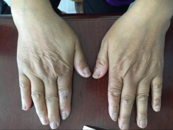 ��Ůʿ˫�ֽ���ָ��ؽڡ���ָ�ؽڡ�˫��ؽ���ѹʹ������ʾָ����쾱������