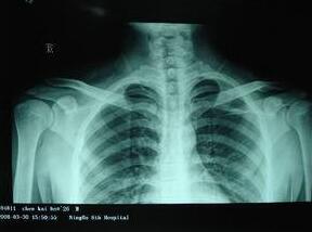 ��ѧ�Ʒ��������ѷ�ʪ��ʹ