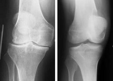 ��x��Ƭ�Ͽ������Կ�������ǰ��Ĳ�ͬ�����ͱ��ѻָ�����