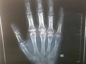 ��Ůʿ�Ƚ����ص���ָ�ؽڼ��ͼ