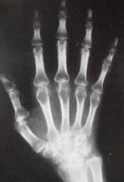 ���ƺ�ԬŮʿ��ָ����֢״��ʧ�ܿ�