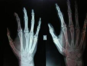 ���ʪ�Թؽ��ײ��� ��ҽ�������缲