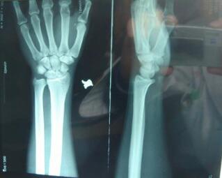 �������ƺ��Է��Ѿ��ָ�����