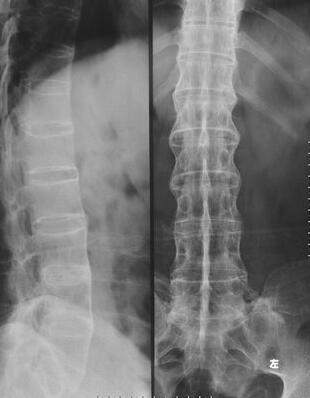 ǿֱ���������赸����