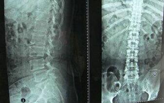 �ܾ����� ��ѡ����ʹ��ѧ����ǿֱ