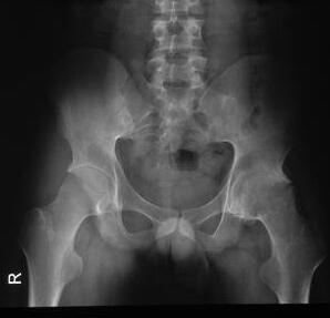 25��С����ʧ�� ֻ��ǿֱ�Լ�����