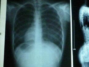 ׷���������չ���ǿֱ