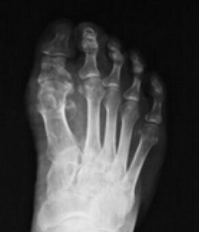 ������֣��ʹ���ʪ��ҽԺ��ʪ�ư���ʹ������������ʹ