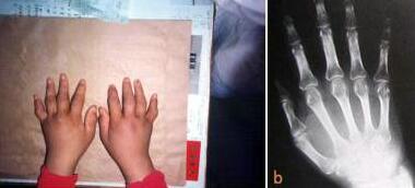 ���������ʪ�Թؽ����赲�˽���