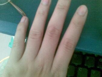 ����˯��ʪ�ذ� �������ʪ�Թؽ��ײ���