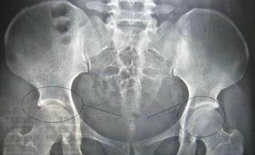 ����֣��ʹ���ʪ��ҽԺ��ʪ����ҽ���κö���ǿֱ