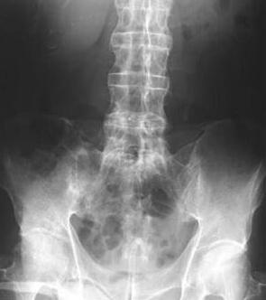 ���ƽ���ʱ���¼���xͼ��ʾǿֱ�Լ������� 