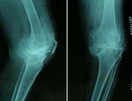 �������ʪ�����޹�����ԺΪ����� �ɹ�