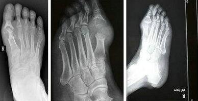 �ྡ�ʲ��� ֻ��ʹ��