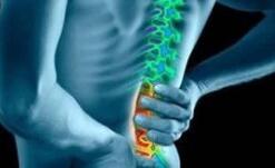 强直性脊柱炎 强直性脊柱炎