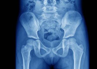 X���¹ؽ�ʾ��ͼ