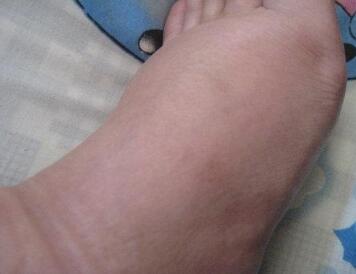 �����ʾ���ʹ�� ������ҽ���ʹ��