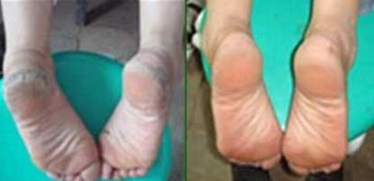 ���ƹ�������ʹ�� Сѧ��ʦ�಻����