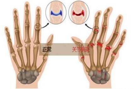 ���������ϳ���֢ �ҵ������ٴ� 