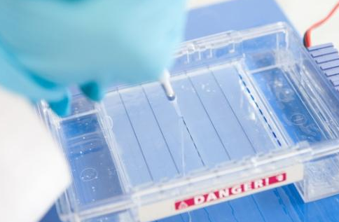 郑州治疗类风湿性关节炎医院哪家好 郑州治疗类风湿性关节炎医院哪家好