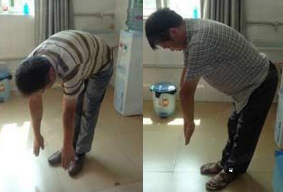 郑州哪个医院治疗强直性脊柱炎效果好 郑州哪个医院治疗强直性脊柱炎效果好