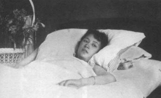 得了类风湿关节炎患者会不会瘫痪? 得了类风湿关节炎患者会不会瘫痪?