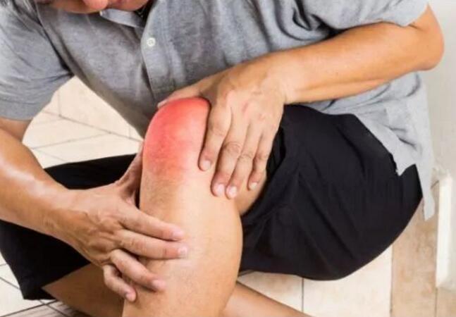 十个痛风误区:尿酸高,漂亮高就一定得痛风? 十个痛风误区:尿酸高,漂亮高就一定得痛风?