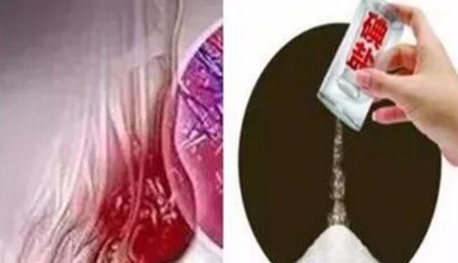 郑州痛风医院_痛风尿酸高,这种盐注意要少吃 郑州痛风医院_痛风尿酸高,这种盐注意要少吃