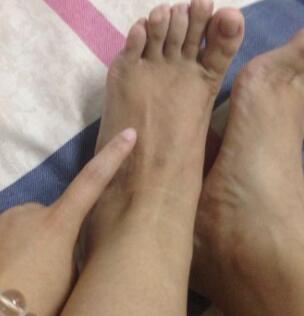 郑州风湿病医院好不好.jpg 郑州风湿病医院好不好