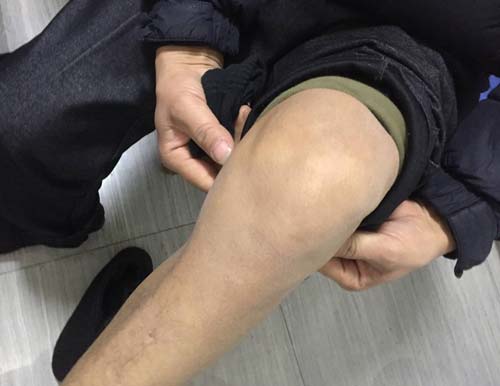 郑州痛风风湿病医院.jpg 郑州痛风风湿病医院