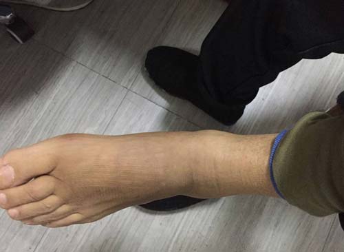 郑州痛风风湿病医院.jpg 郑州痛风风湿病医院