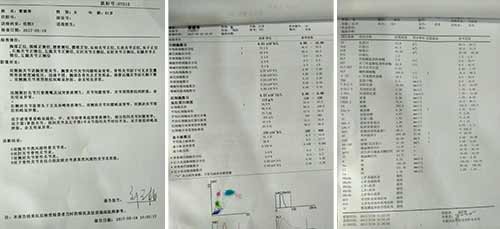 郑州痛风风湿病医院.jpg 郑州痛风风湿病医院
