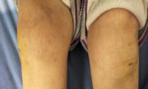 郑州痛风风湿病医院.jpg 郑州痛风风湿病医院