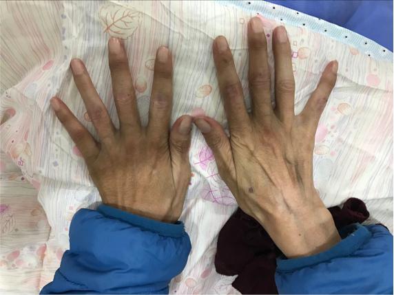 ֣��ʹ���ʪ��ҽԺ