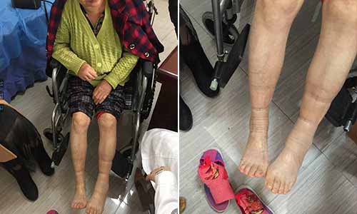 郑州痛风风湿病医院.jpg 郑州痛风风湿病医院