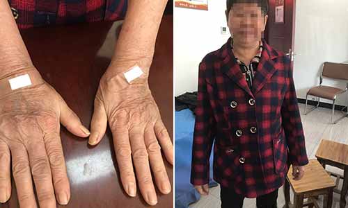 郑州痛风风湿病医院.jpg 郑州痛风风湿病医院