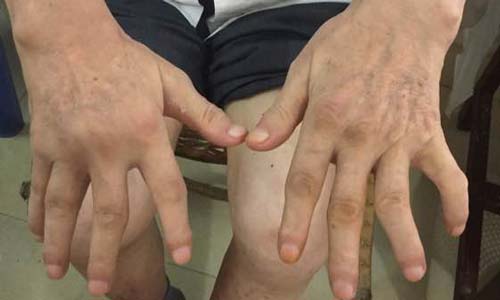 ֣��ʹ���ʪ��ҽԺ