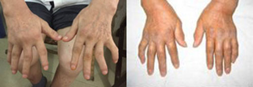 ֣��ʹ���ʪ��ҽԺ