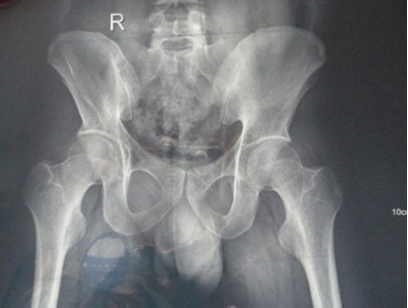 ֣��ʹ���ʪ��ҽԺ