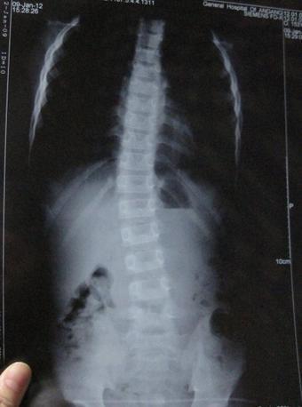 ֣��ʹ���ʪ��ҽԺ