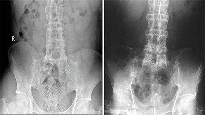 ֣��ʹ���ʪ��ҽԺ