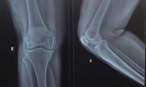 郑州痛风风湿病医院.jpg 郑州痛风风湿病医院