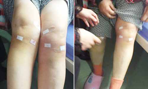 郑州痛风风湿病医院.jpg 郑州痛风风湿病医院