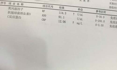 郑州痛风风湿病医院.jpg 郑州痛风风湿病医院