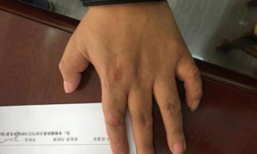 郑州痛风风湿病医院.jpg 郑州痛风风湿病医院