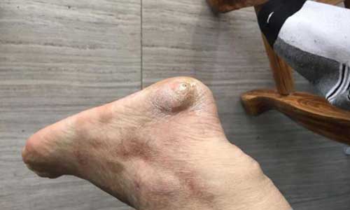 ֣��ʹ���ʪ��ҽԺ