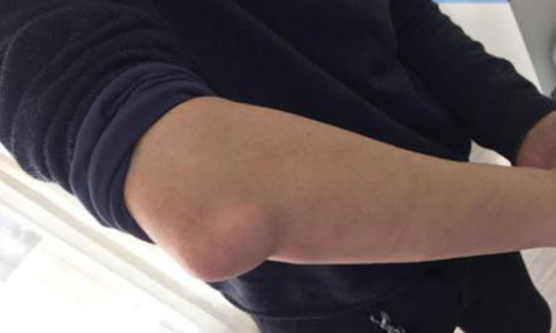 ֣��ʹ���ʪ��ҽԺ